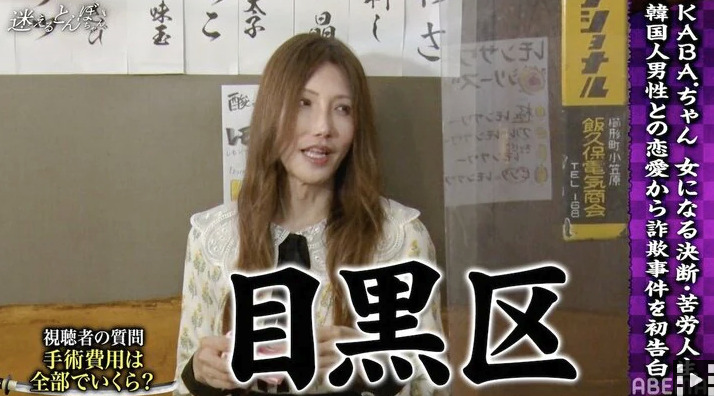 氷川きよしさんと同年齢の時期に性別転換をしたKABAちゃん